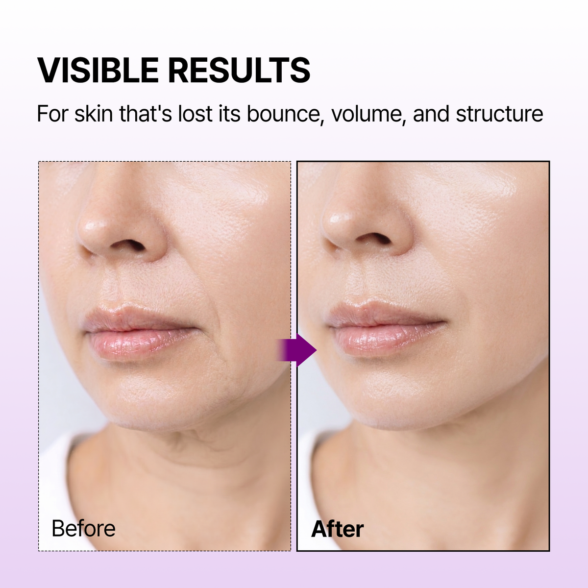 Calcium Bonding Serum & Cream Duo