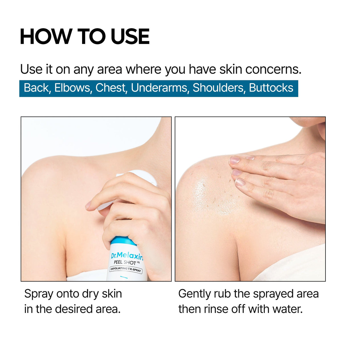 Peel Shot Exfoliating TX Spray